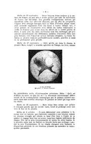 page suivante →