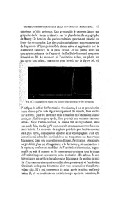 page suivante →