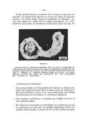 page suivante →