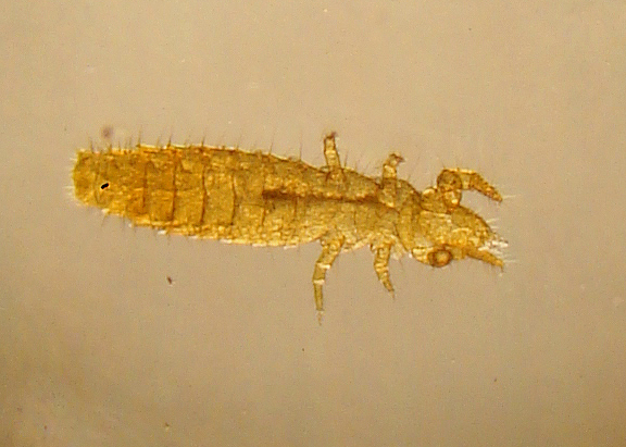 Fichier:Protura specimen (Acerentomon species) micrograph.jpg