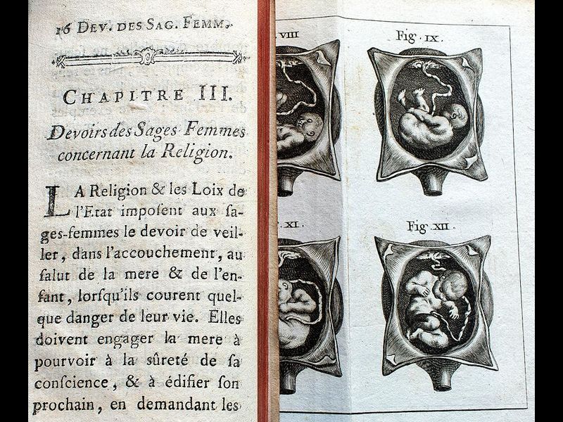 Fichier:Exposition Stanislas-BU-2016-Diapositive (105).JPG