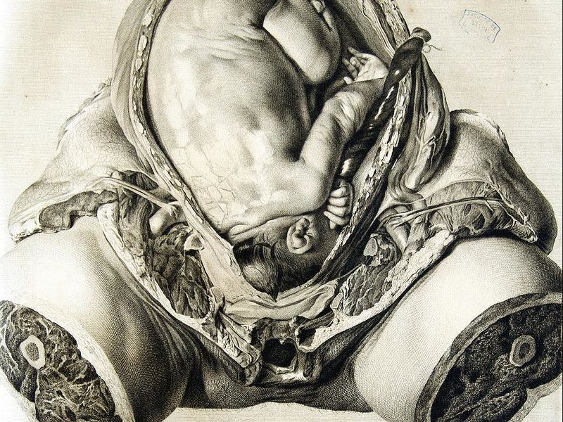 File:Exposition Stanislas-BU-2016-Grands-formats-Diapositive (12).JPG